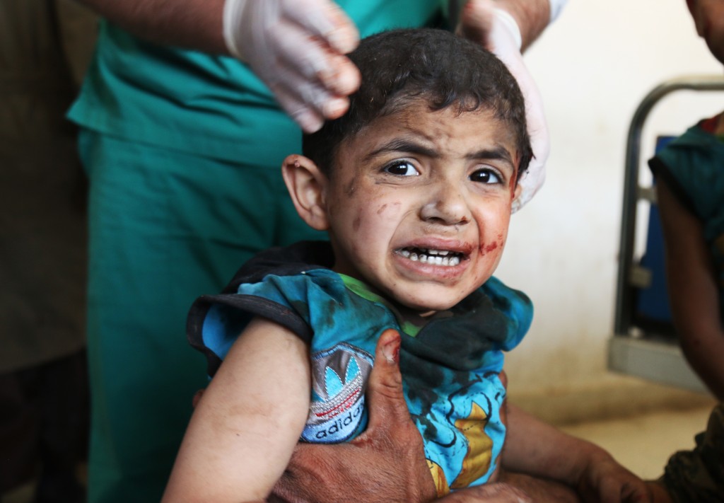 A Syrian child receives treatment at a makeshift hospital following an air strike on a vegetable market in Maaret al-Numan, in Syria's northern province of Idlib, on April 19, 2016. Suspected government air strikes killed at least 44 civilians at two markets in a part of northwestern Syria controlled by the war-torn country's Al-Qaeda affiliate, the Syrian Observatory for Human Rights said. / AFP PHOTO / Mohamed al-Bakour