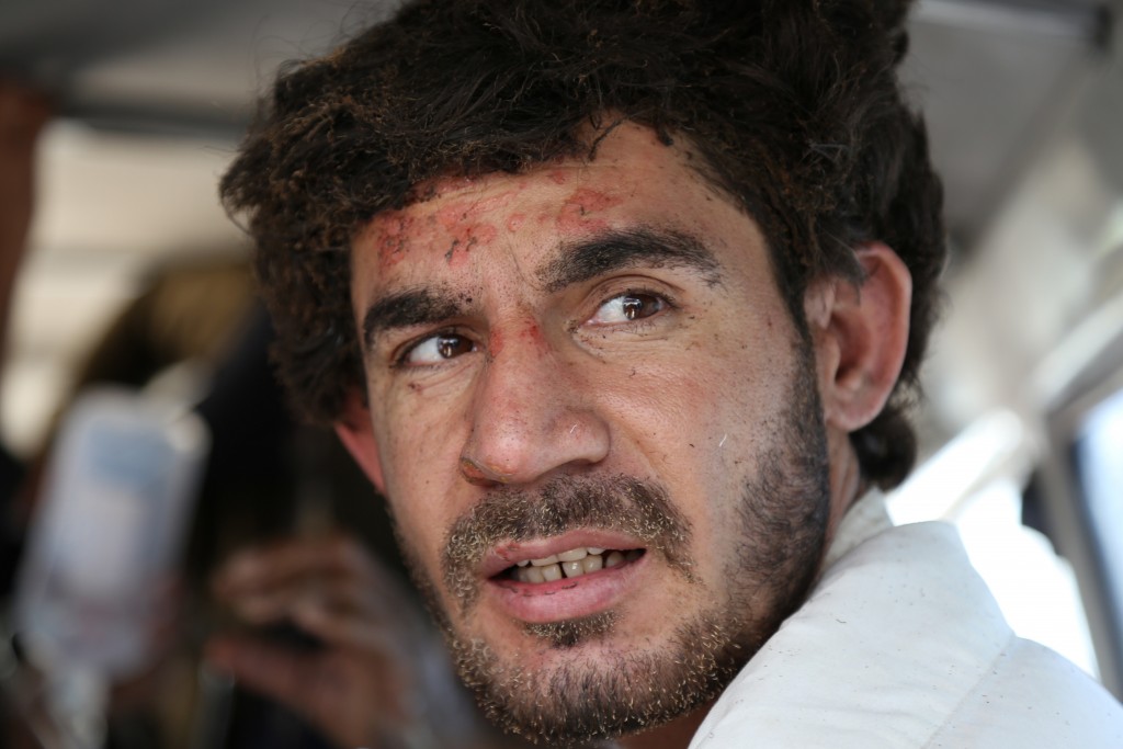 An injured Afghan man sits in an ambulance in Ghazni on May 8, 2016, following an accident on the main Kabul-Kandahar Highway.    Two buses and an oil tanker collided on a major highway in eastern Afghanistan Sunday killing at least seven people, officials said, in the latest deadly road accident in the war-battered country. / AFP PHOTO / SAYED ZAKERIA